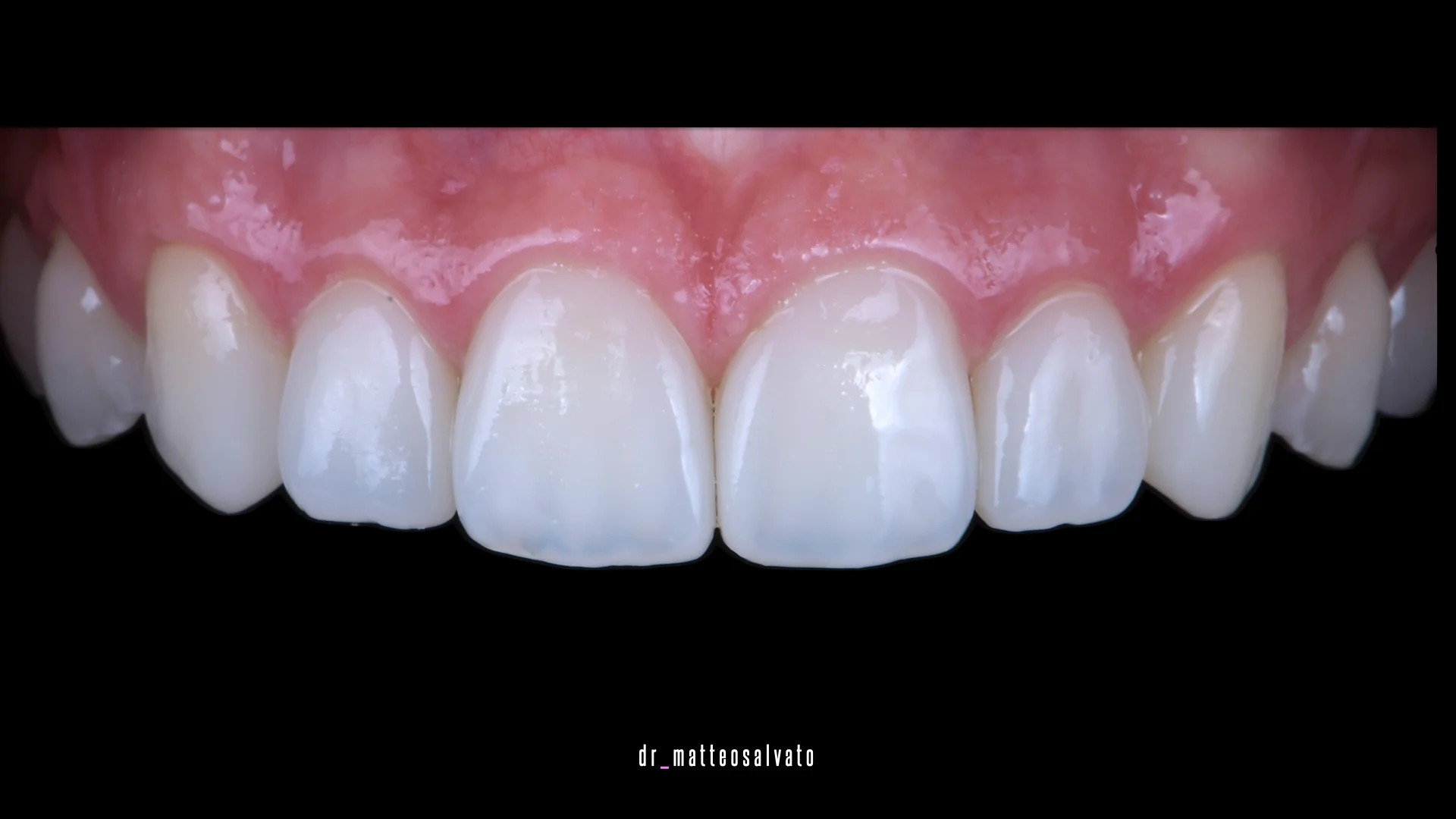 Conservativa adulti dopo