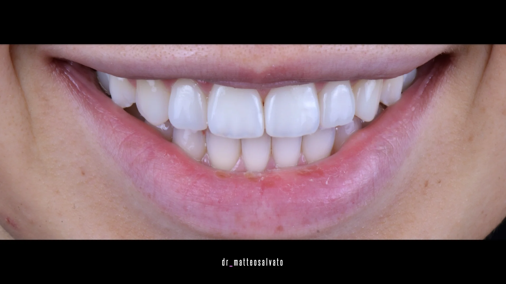 Conservativa adulti riva del garda - dopo