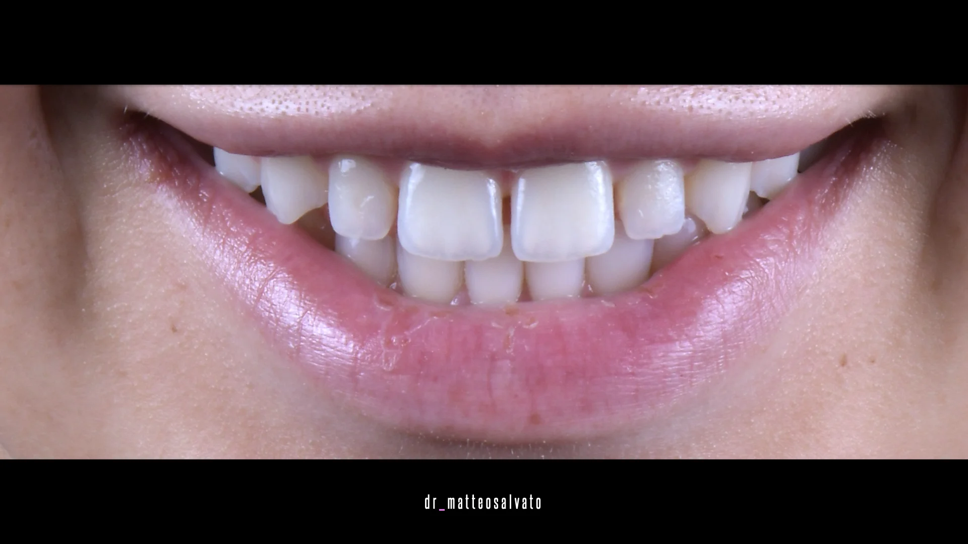 Conservativa adulti riva del garda – prima Conservativa adulti riva del garda - prima