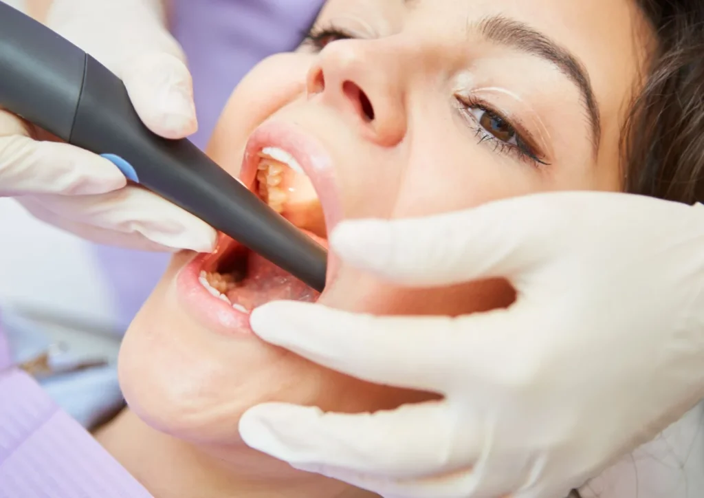 Endodonzia e ritrattamenti - dentista a riva del garda