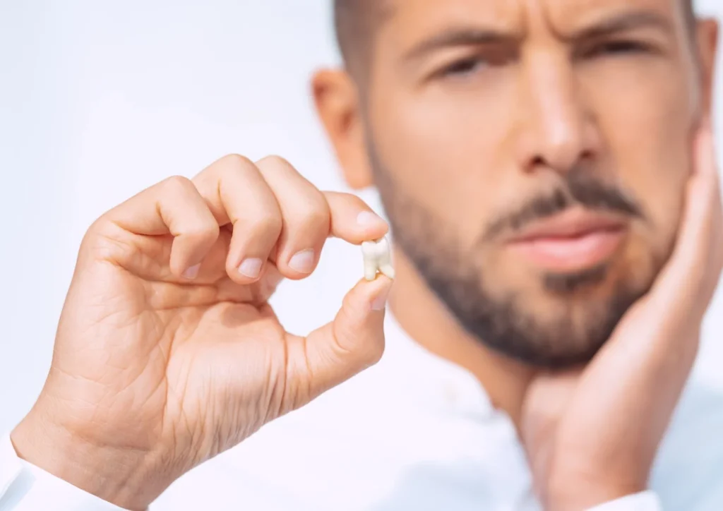 Estrazione denti del giudizio - chiama studio dentistico dutto