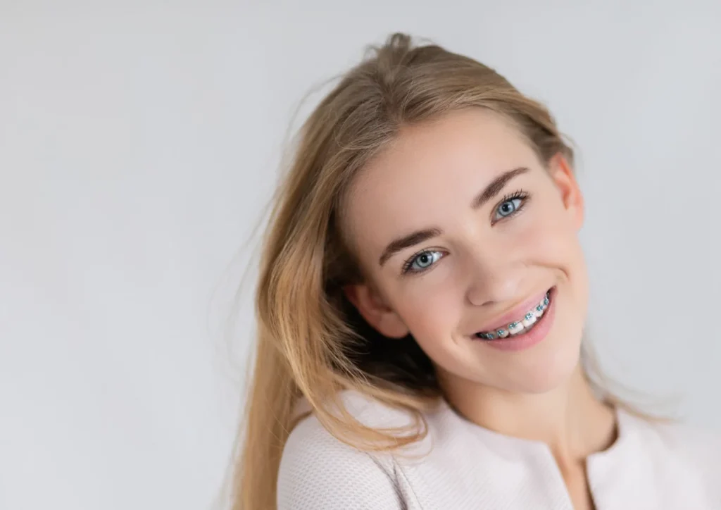 Ortodonzia fissa - bambini e adulti studio dentistico dutto