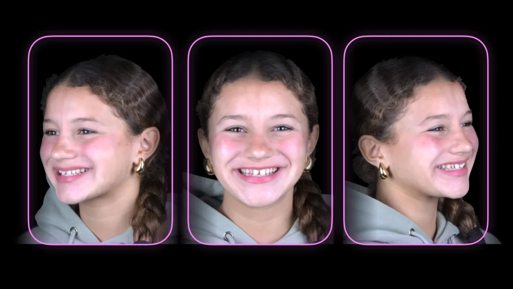 Conservativa - step 1