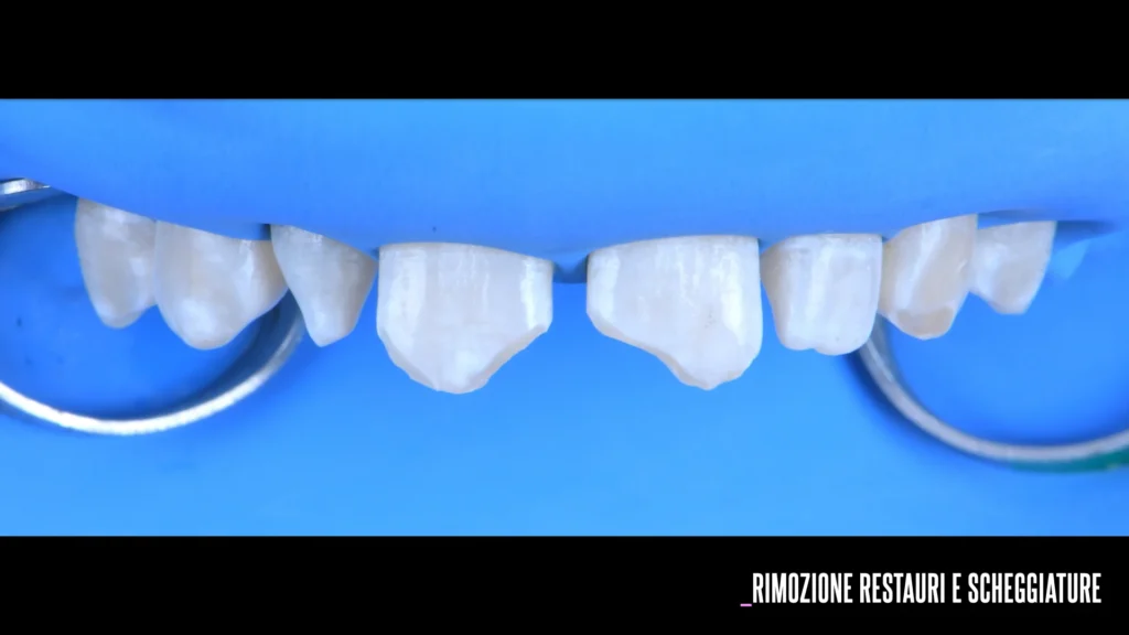 Conservativa - step 3