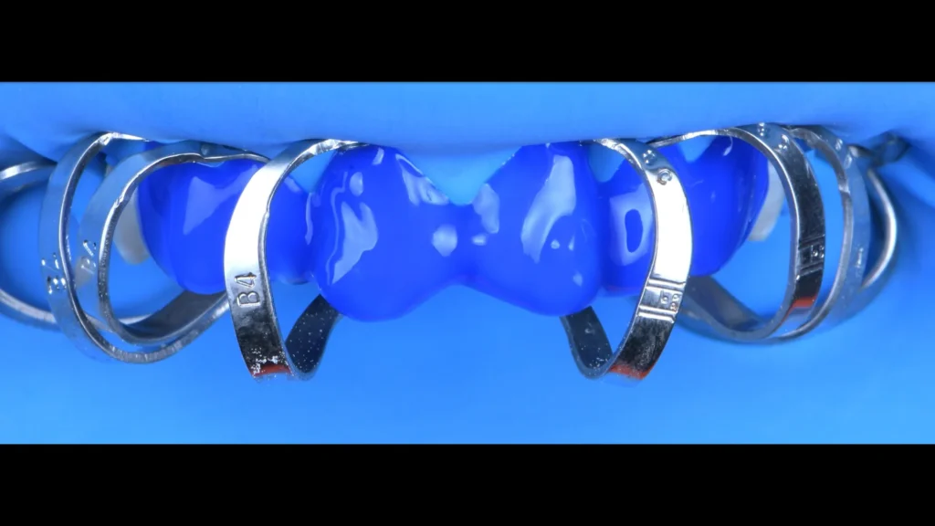 Conservativa - step 4