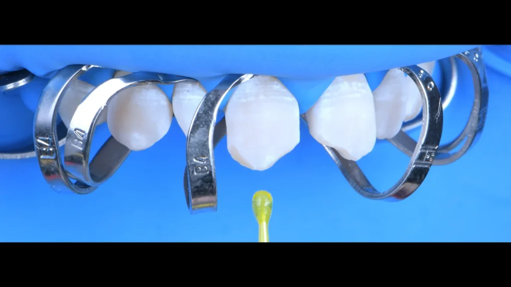 Conservativa - step 5