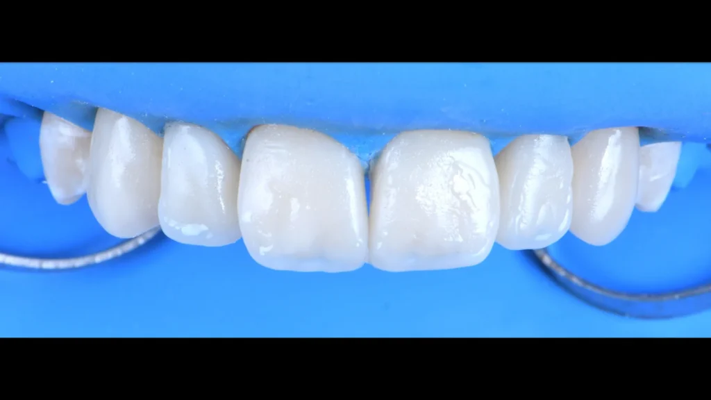 Conservativa - step 7