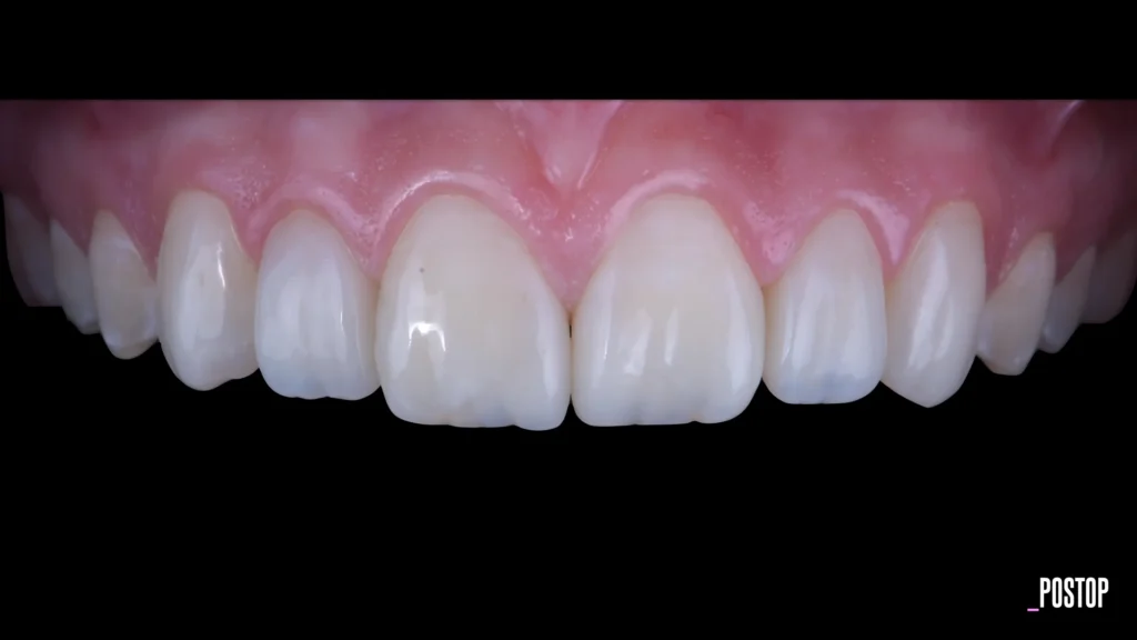 Conservativa - step 8