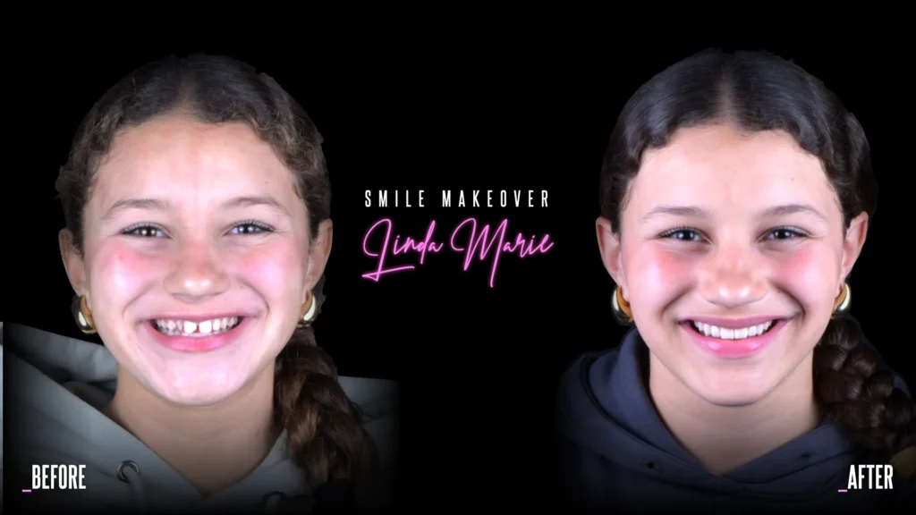 Conservativa - step 9